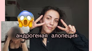 Андрогенная алопеция | АГА | я сходила к трихологу