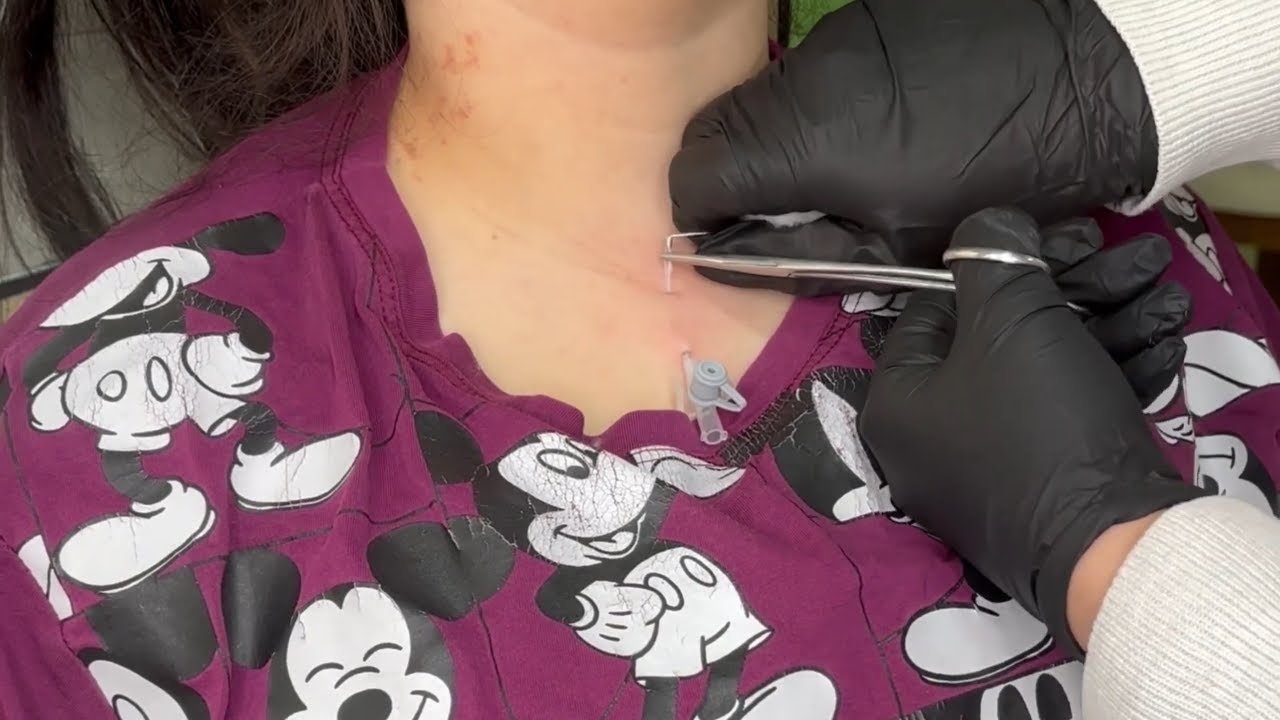 Surface Piercing Guide 🔥 Pain, Healing & Jewelry Styles