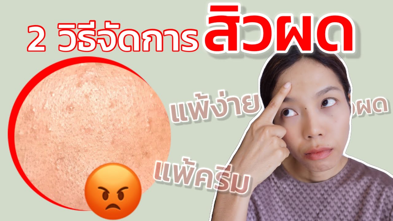 สิว ผด หน้าผาก