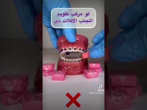 لو مركب تقويم تجنب الاكلات دي تقويم تقويم الأسنان مريم غريب