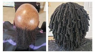 Alopecia Crochet Hairstyle |DETAILED BRAID PATTERN ⬅️ #alopecia by AKIYIAKELLY 1,642 views 1 month ago 7 minutes, 51 seconds