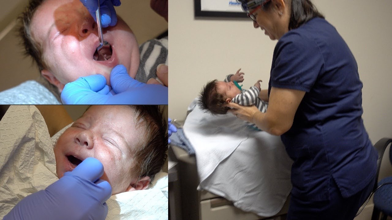 BABY'S FIRST SURGERY YouTube