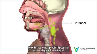 Italian - What is Oral or Mouth Cancer? Signs & Symptoms. Head and Neck Cancer screenshot 1