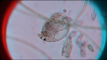 cladocera 20X objective, 3D anaglyph (use red/blue glasses)
