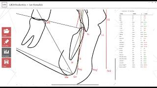 Cephalometric Analysis LBOrthodontics screenshot 1