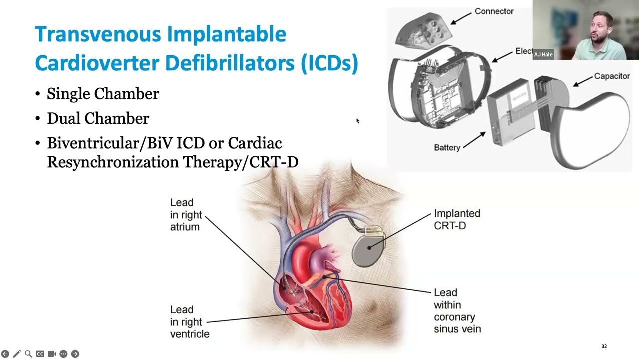 Ep3 Pacing Modes and NBG Codes - CVEF - Cardiac Device/EP Lecture Series