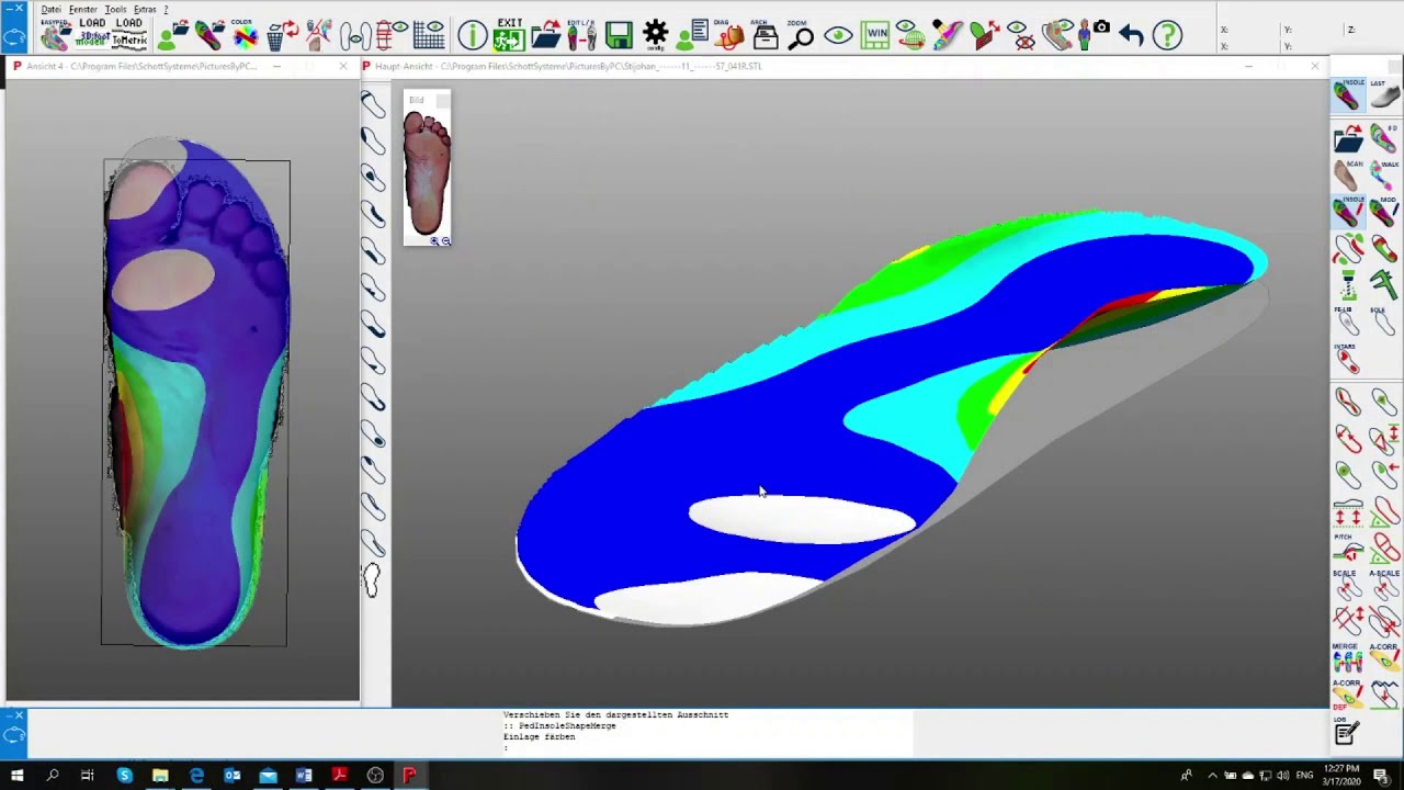 Insole Designer - MERGE - 3D Foot Measurement - YouTube