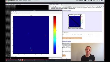 Resting State FSLNETS: Pre-Practical Introduction Video