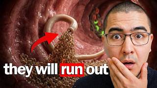 Why Doctors Don't Tell You About This Simple Parasite Cleanse. Doctor Explains Top 2 Foods To Cleanse Parasites