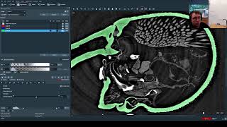 3D Segmentation from Antscan Micro-CT Scans
