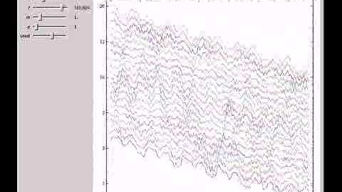 The Fermi-Pasta-Ulam Experiment