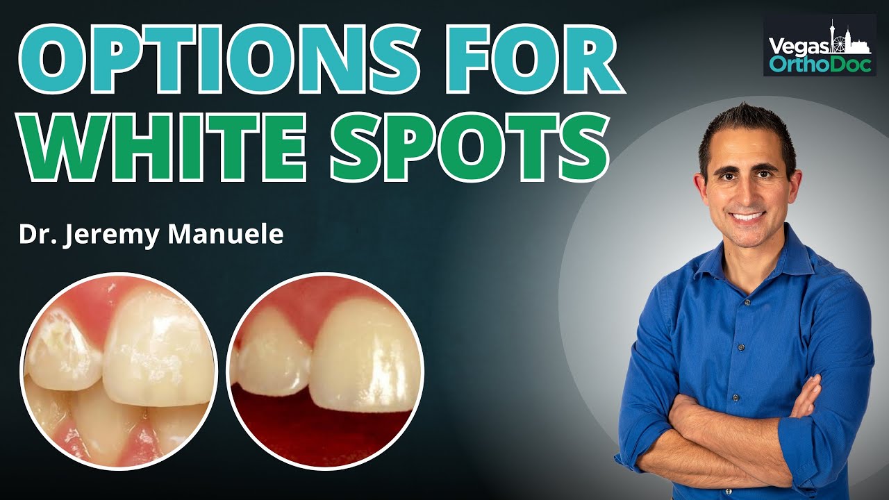 Белые пятна, анкилоз и декоронация: варианты лечения