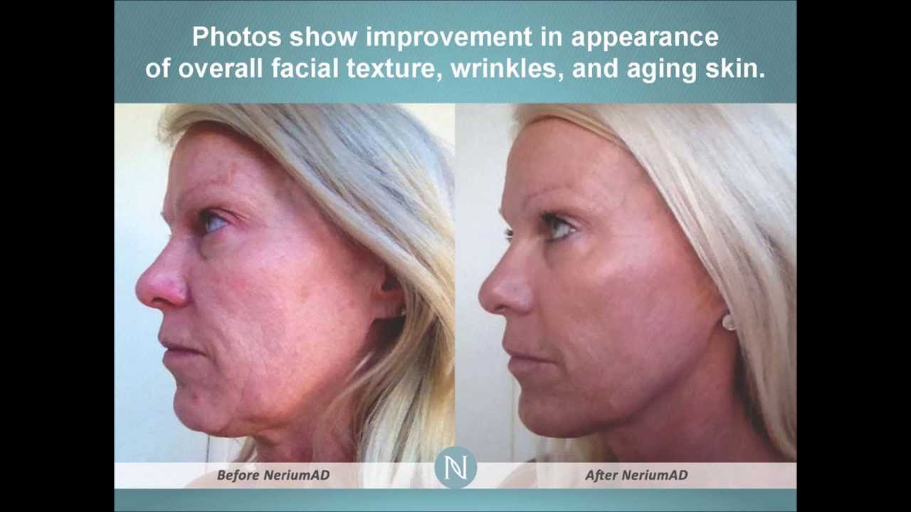 Nerium AD Brand Partner Jayne Altic