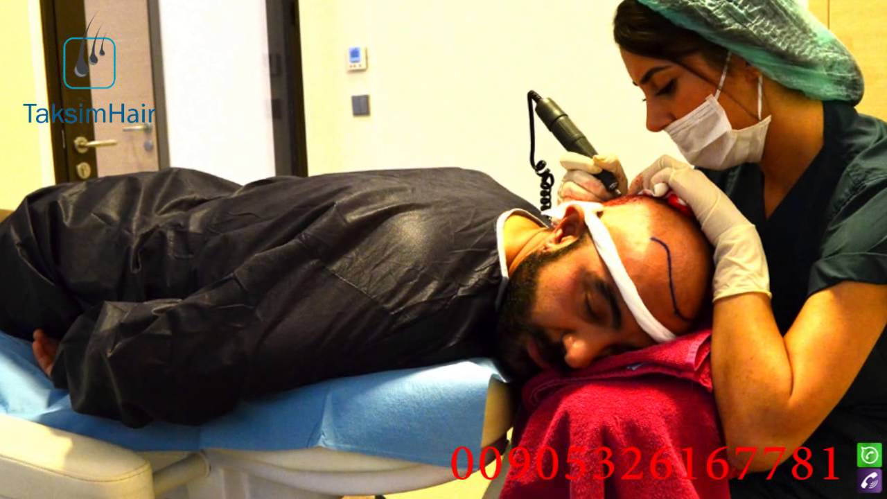زراعة الشعر وعلاج الصلع في تركيا في المستشفى الاول لزراعة الشعر تجربة السيد شاكر Youtube
