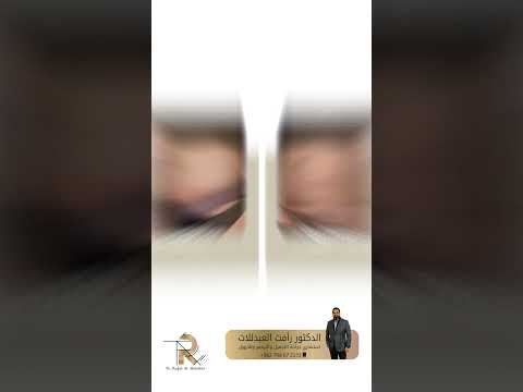 شفط الدهون و نحت الجسم وانقاص الوزن ؟