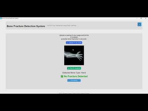 Bone Fracture Detection System