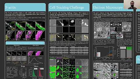 MAIS Poster 68: Weakly supervised learning for semantic segmentation of microscopy images