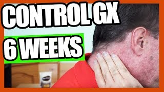 Control GX Follow Up at Six Weeks- Maintenance Mode