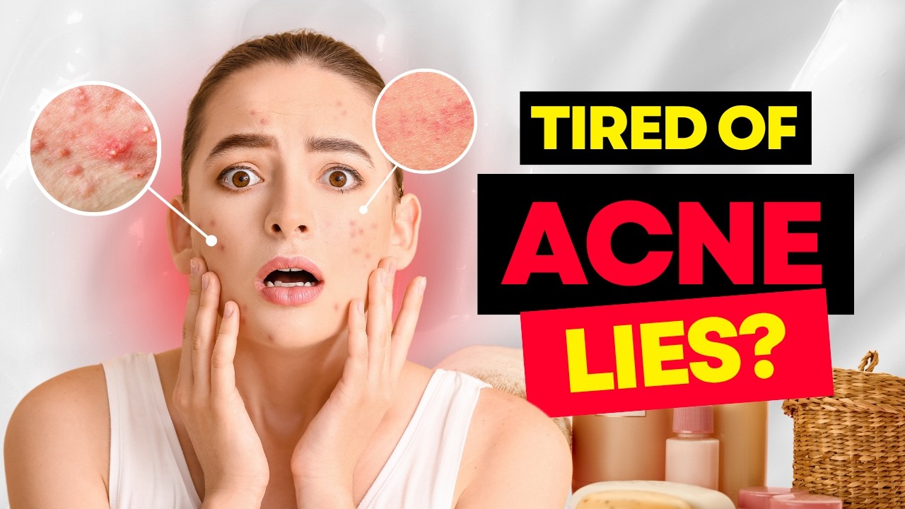 Acne Myths Busted: What Really Works to Clear Your Skin
