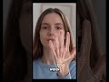 cEDS vs hEDS 💛 Not All Types of EDS Are the Same | EDS Awareness Month Day 8