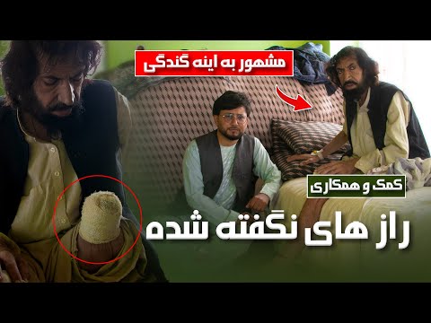 شاه پور شاه عالمی بعد از قطع شدن پای ش در چی وضعیت است