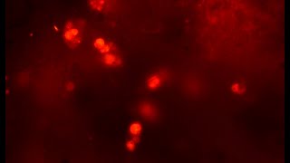 Playing with AO fluorescence @ThaiMicrocosmos