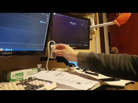 Vista previa del video: Ver orden de MisRX