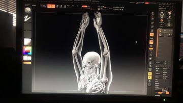 CT Scan Reconstruction