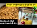 कभी ना लगाना ये फेसपैक वर्ना कोई पहचान नहीं पायेगा Spotless Glowing Skin in 1 Use | Whitening Mask