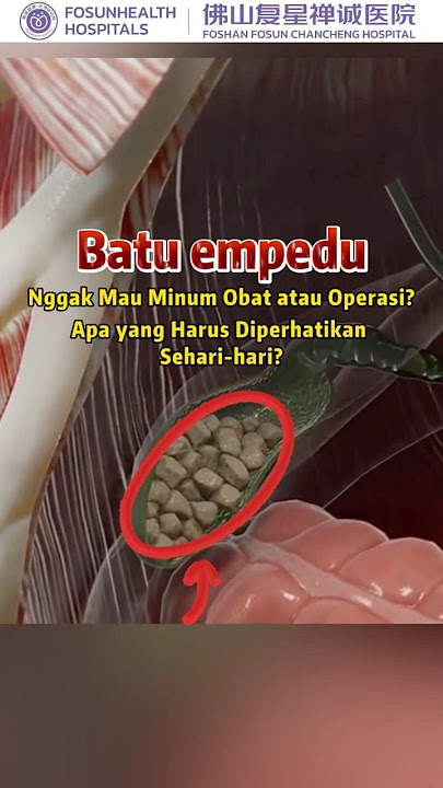 Batu Empedu, Nggak Mau Minum Obat atau Operasi?#sehat #health #batu #healthtips #foryou #habits #fyp