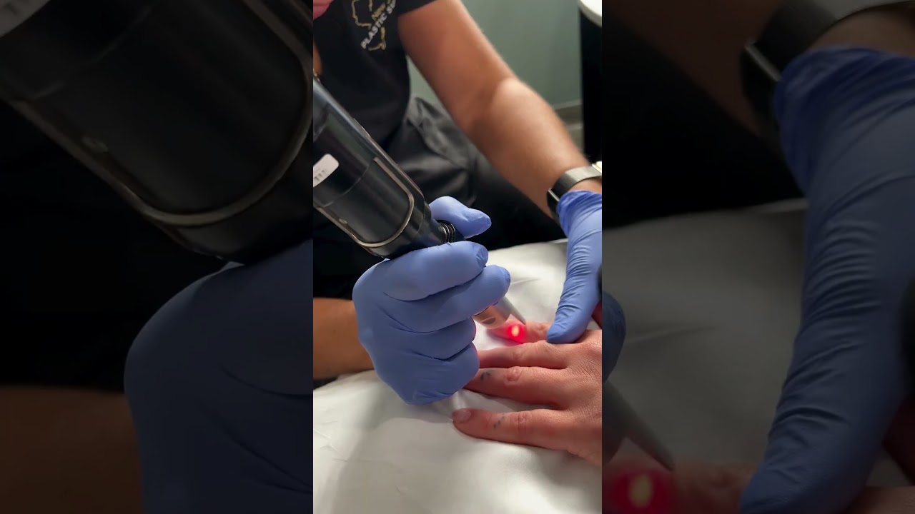 Laser and Non-Invasive Treatments for Glowing Skin ✨