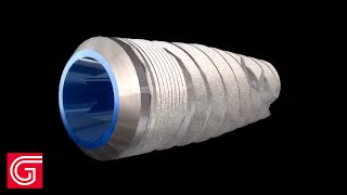 The Glidewell Ht Implant System Combines Clinically Proven Features With Contemporary Innovation.