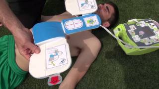 09 AED SEMI AUTOMATIC EXTERNAL DEFIBRILLATOR)