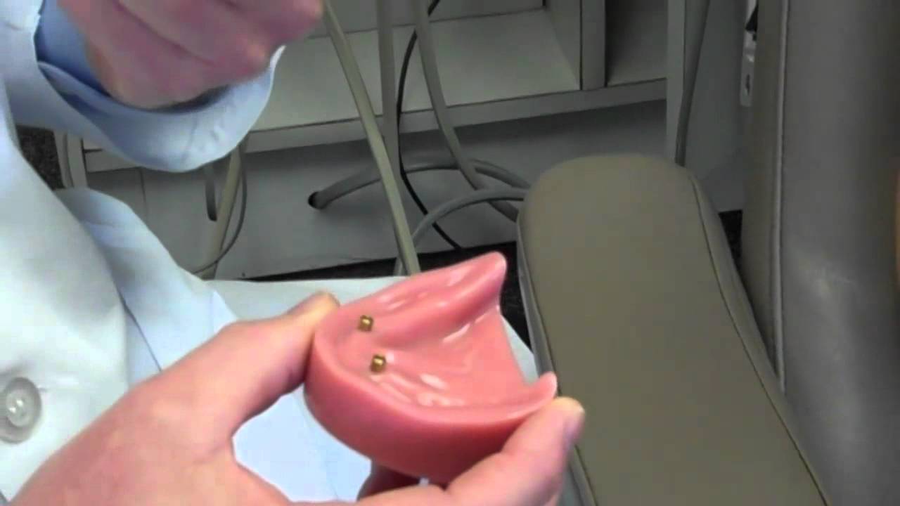 Winchester Ohio Dentist - Dentures for Winchester Ohio Patients