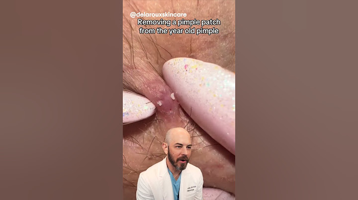 Come rimuovere un brufolo vecchio di un anno👀? (credito: delarouxskincare su TT) #brufolo #soddis...