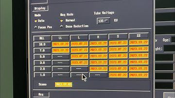 How to perform air calibration CT Scanner Toshiba