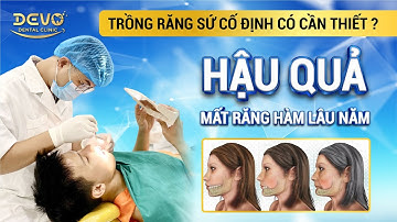 Trồng răng sứ cố định 2024? Hậu quả của mất răng hàm lâu năm?