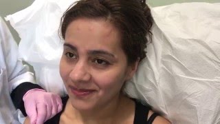 Under-Eye Restylane Filler Injections