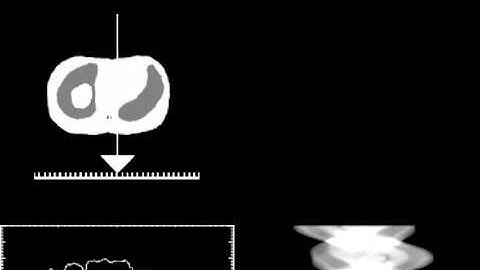 Filtered Back-Projection in SPECT