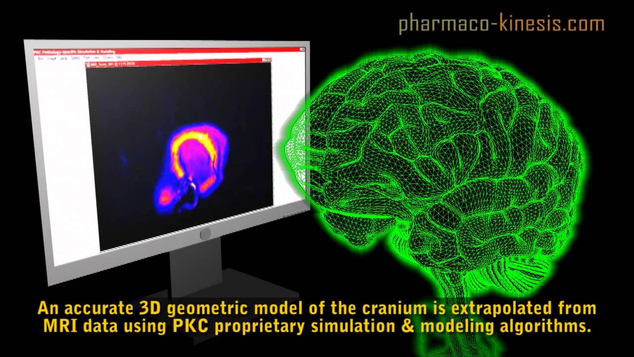 Pharmaco-Kinesis Corp -- Pathology Specific Simulation Modeling
