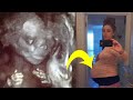 Woman’s Baby Bump Keeps Growing, Then Doctor Spots Something Unusual In Ultrasound