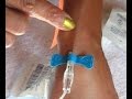 Mastering Vein Assessment and Blood Draw Techniques