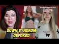 Influencerin faked Down Syndrom für OF