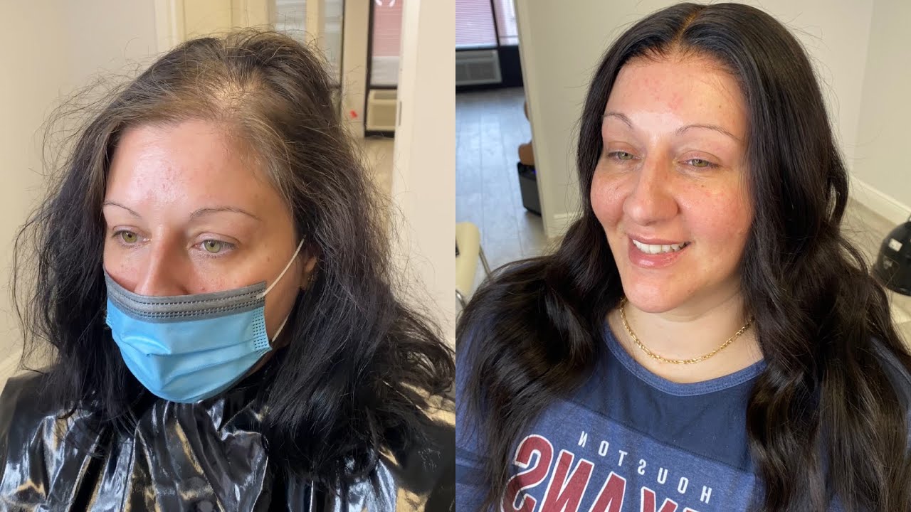 Watch me install a wig on my client | Thinning hairline