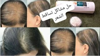 وصفة طبيعية لعلاج تساقط الشعر ونتائجها سريعة ومبهرة ?