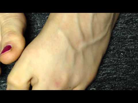 Veiny Feet