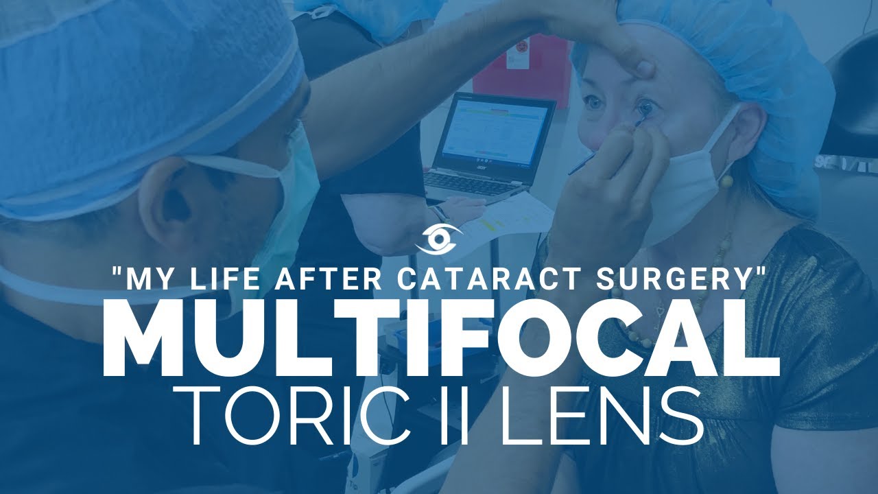 review-of-the-new-multifocal-toric-ii-lens-1st-patient-in-georgia