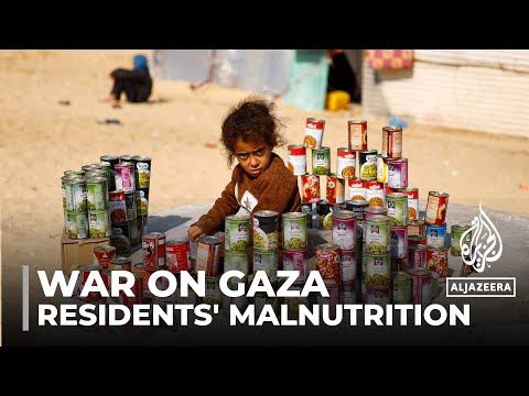 Gaza residents suffer from malnutrition due to limited access to fresh food and clean water