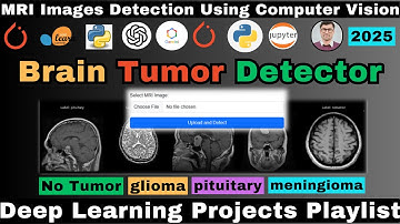 Building a Brain Tumor Detection Using Deep Learning | MRI Images Detection Using Computer Vision