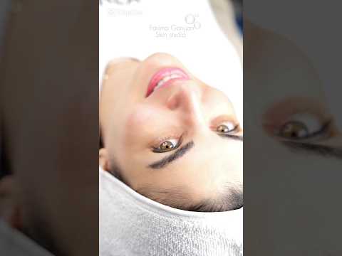 لایه برداری پوست پاکسازی پوست فیشال اسپیرولینا